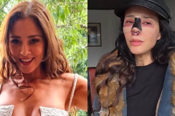 Dorismar denuncia mala praxis en rinoplastia