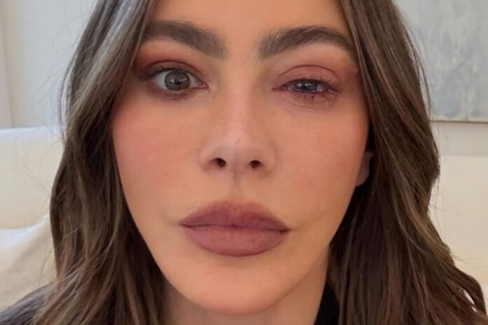Sofía Vergara se ausenta de los Emmy 2025 por una alergia ocular grave que la lleva a urgencias